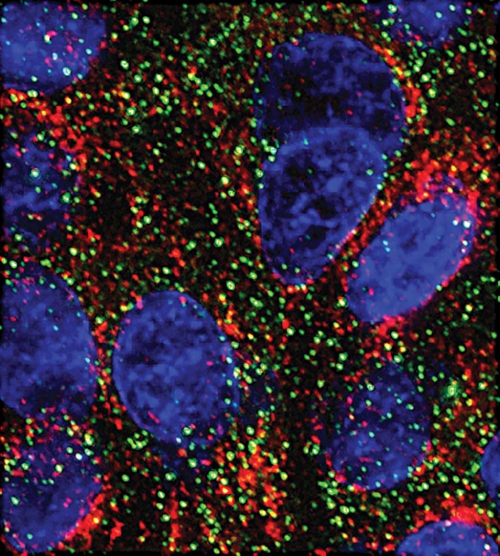 Dos “frenos” genéticos frenan el crecimiento del cáncer de páncreas en el laboratorio